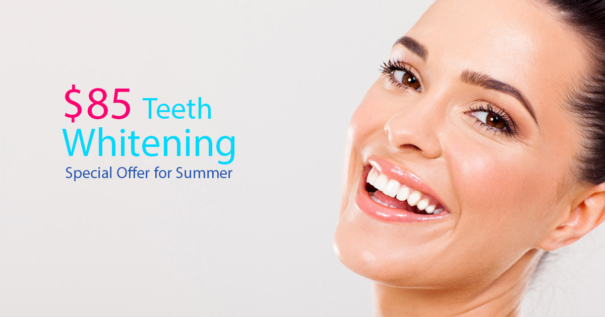 Teeth-Whitening-85-Special