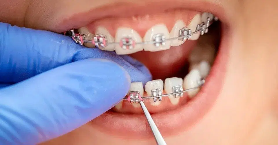 orthodontics-services-near-me